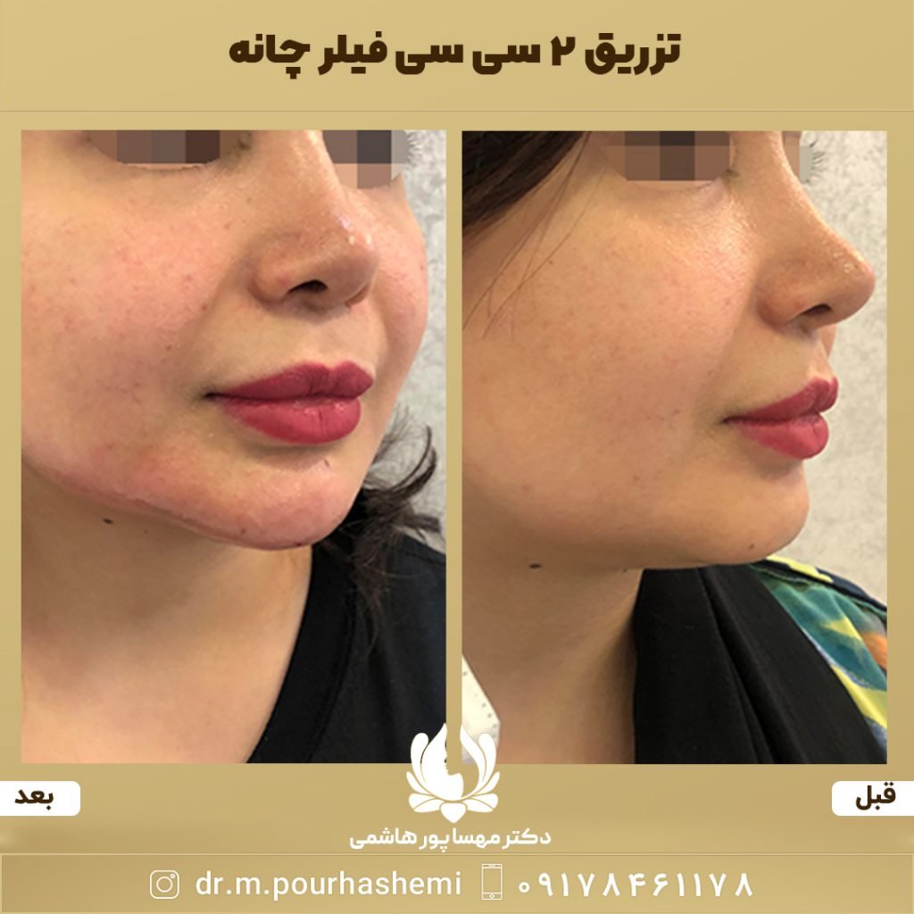 دکتر مهسا پورهاشمی